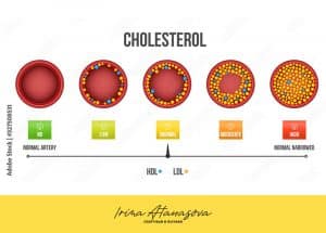холестеролът-ирина-атанасова